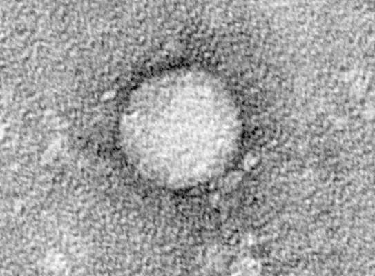 丙型肝炎病毒从细胞培养物中纯化