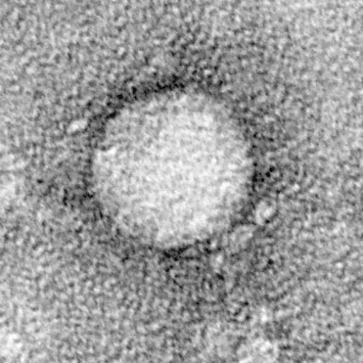 丙型肝炎病毒从细胞培养物中纯化