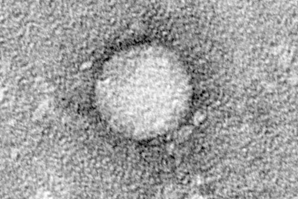 丙型肝炎病毒从细胞培养物中纯化
