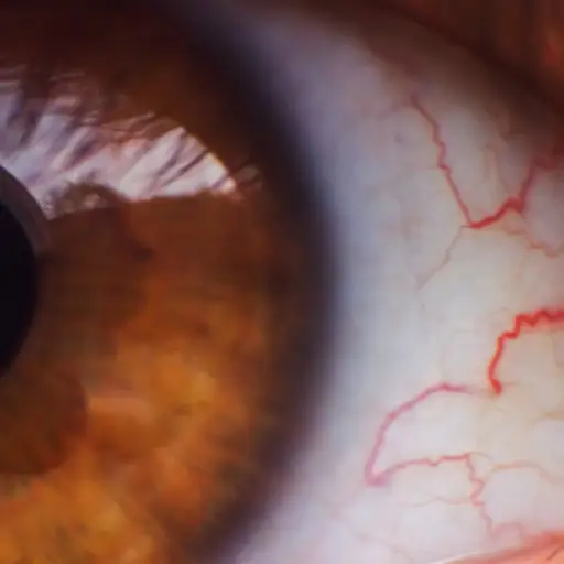 眼球上的静脉,人类的棕色眼睛