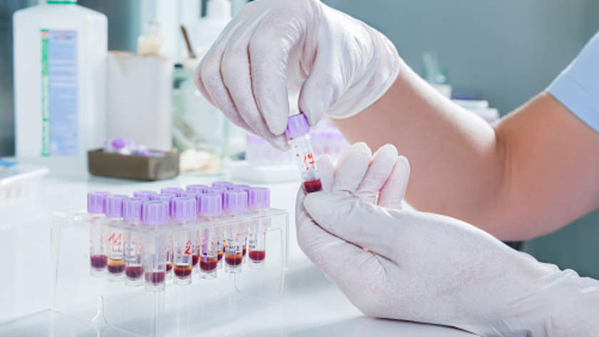Diabetes: 4 Lab Tests for Diagnosis | HealthCentral