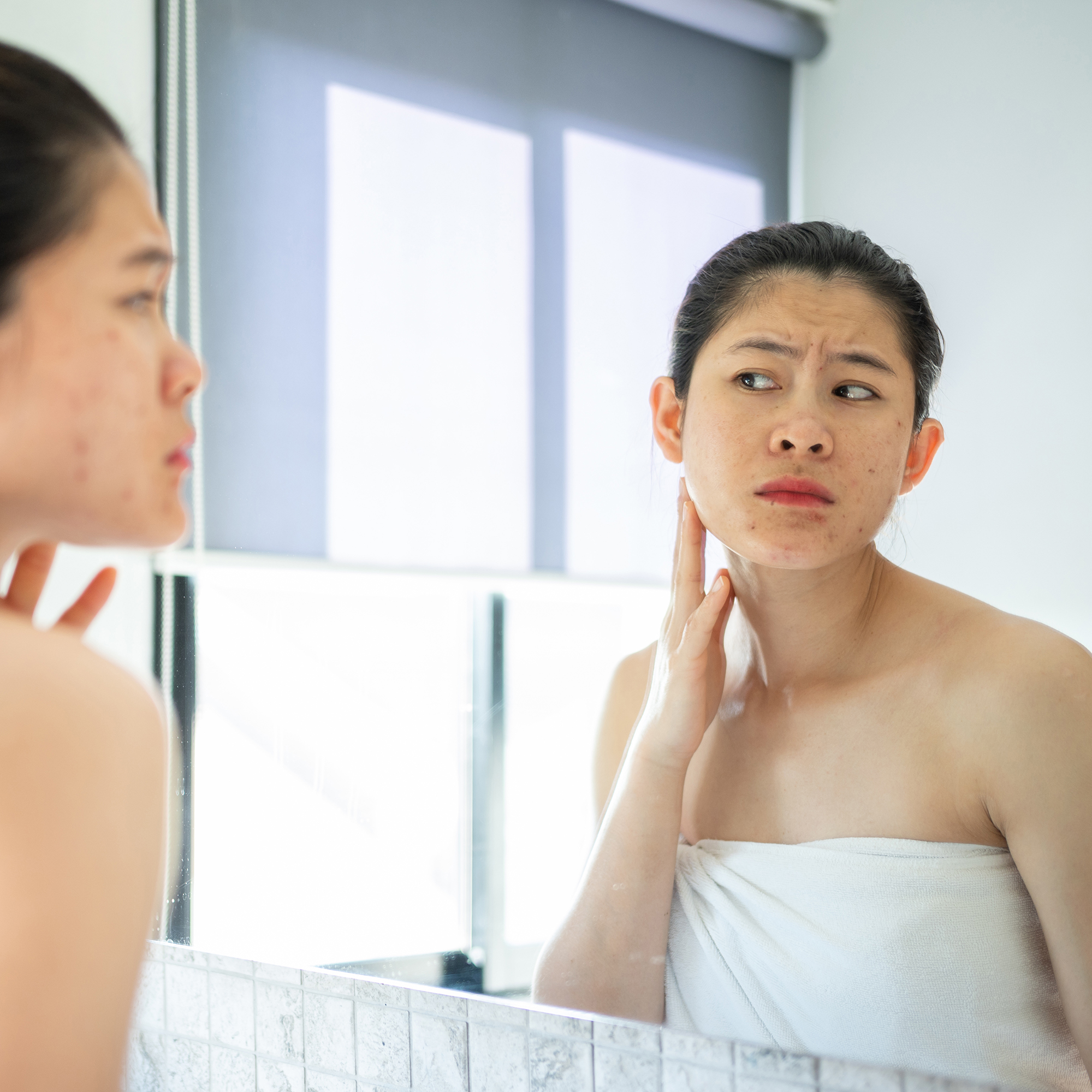 女人在镜子里看着她脸上的粉刺