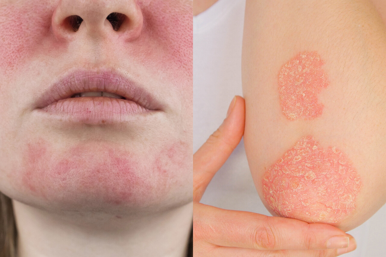 Yalangoch va kulgili voleybol