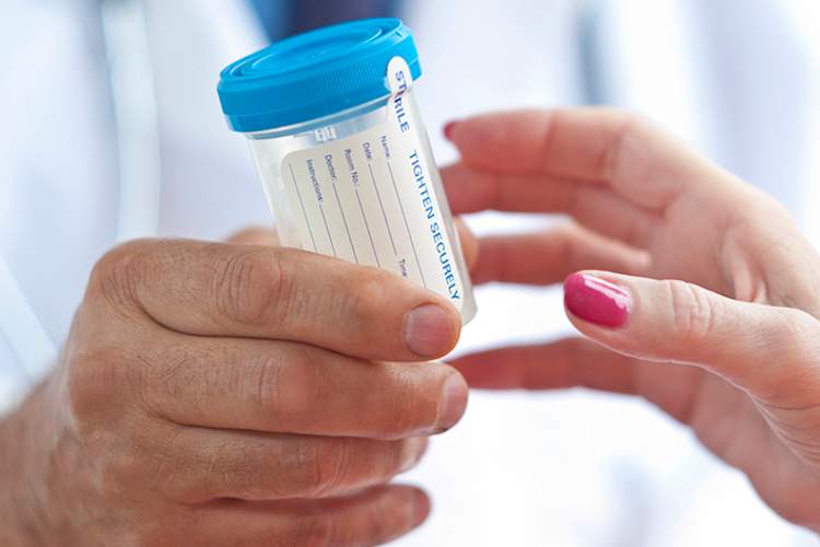 尿液样本容器,用于药物测试。