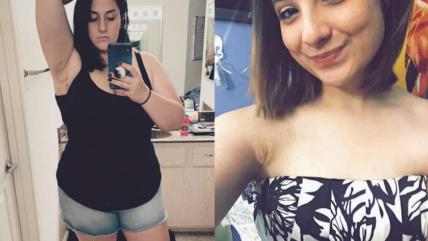 Hs Real Patients Share Their Stories