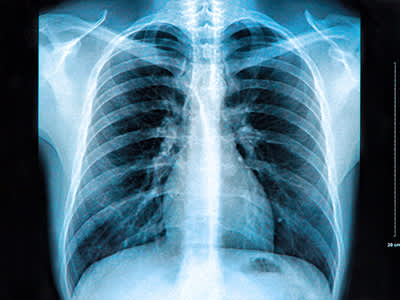 胸部X射线。