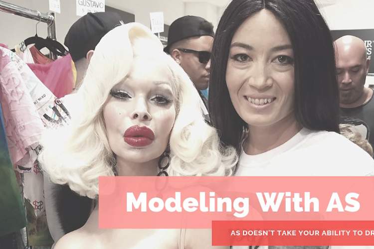 希尔的Charis强直性脊柱炎造型。