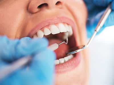 牙科医生检查病人的嘴。