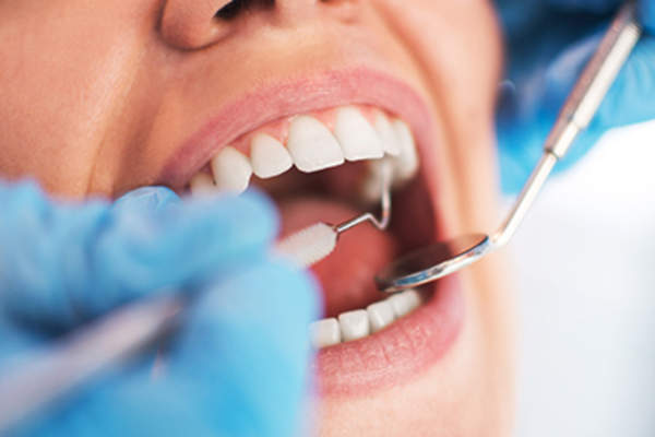 牙科医生检查病人的嘴。