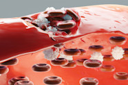 How ITP Hinders Blood From Clotting