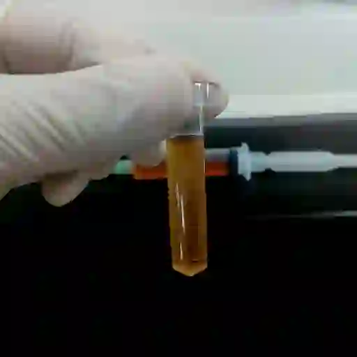 脑脊液