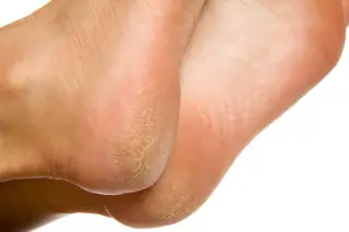 Why Do My Feet Hurt So Bad? 13 Causes and How to Stop the Pain