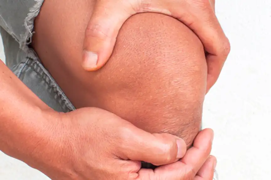 Person holding knee.