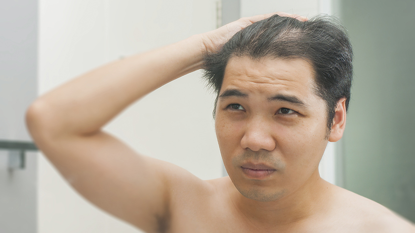 Scalp Psoriasis Embarrassment and How to Cope  Everyday Health