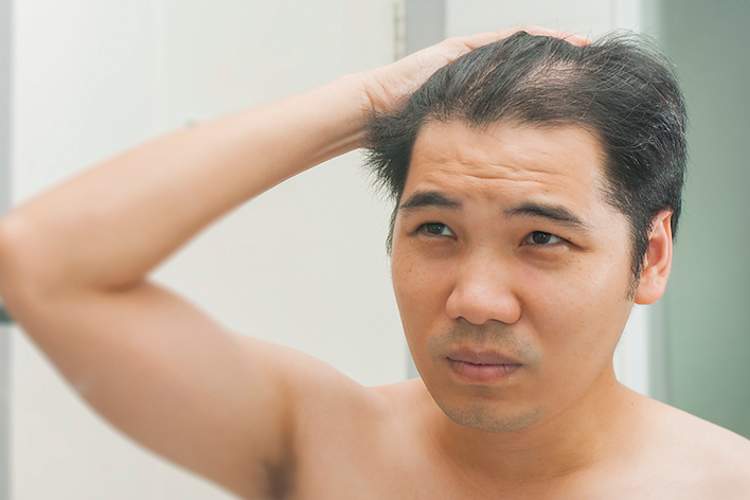曼观察镜中的他的头皮。