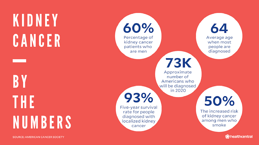 肾癌统计数据:2020年美国确诊人数、男性患者比例、平均确诊年龄、生存率以及吸烟男性患肾癌的风险增加