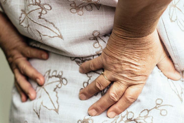 一个因为坐骨神经痛而背痛的女人。