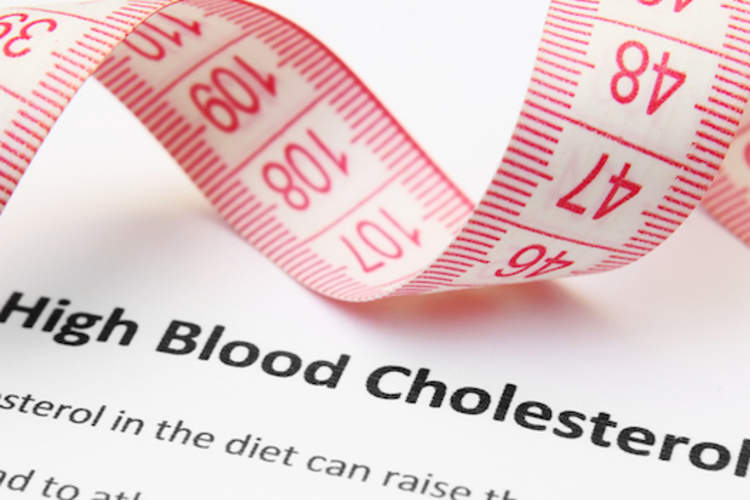 高血胆固醇。