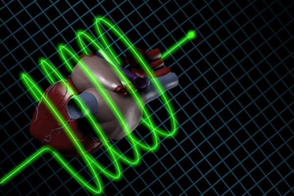 电活动心脏模型。