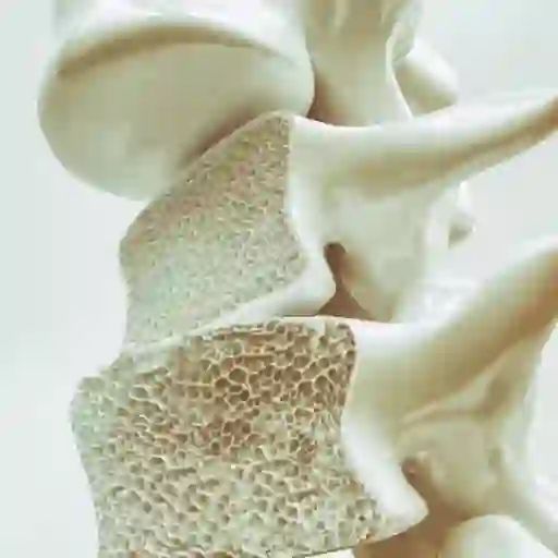 骨质疏松脊柱