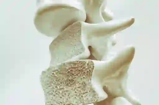 骨质疏松性脊柱