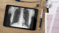 心脏和肺，X线和心电图。