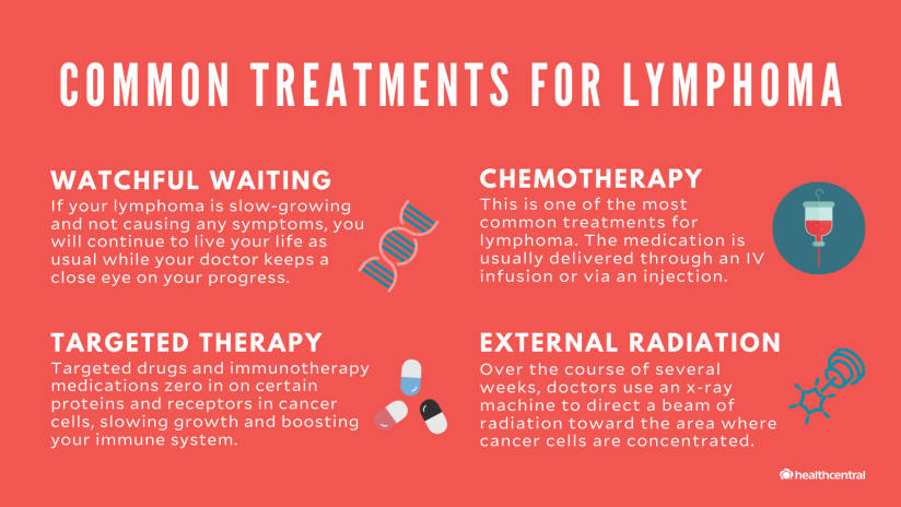 常见的淋巴瘤治疗包括手表等待，化疗，有针对性的治疗和外部辐射