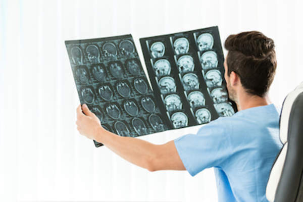 医生检查头部和颈部MRI。