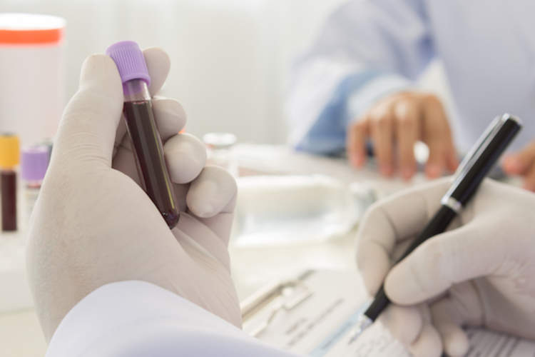 血液测试可预测高血压