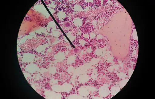 显微镜下PAP涂抹细胞