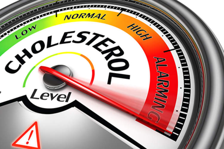 胆固醇米的概念。