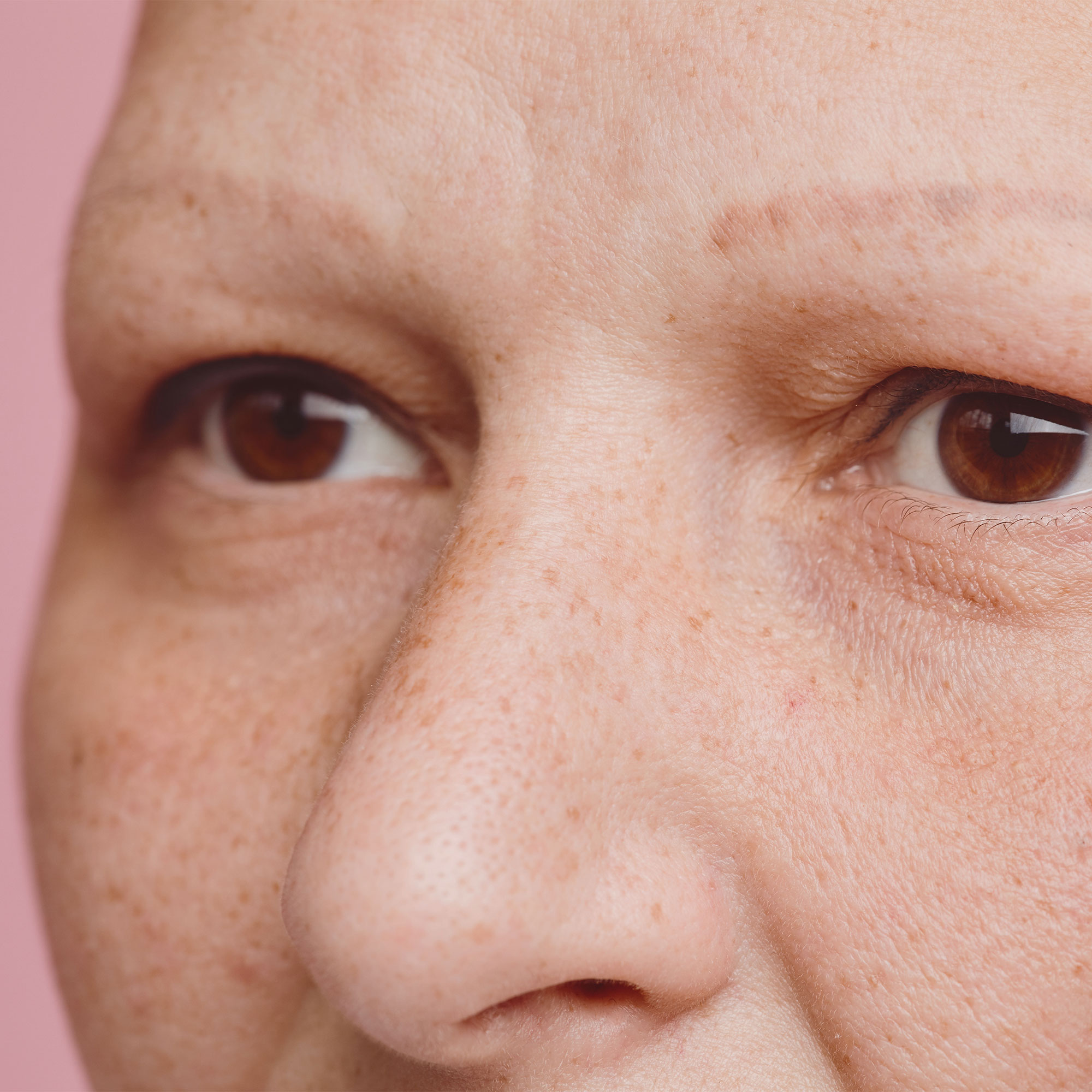 一个没有眉毛和睫毛的女人的特写