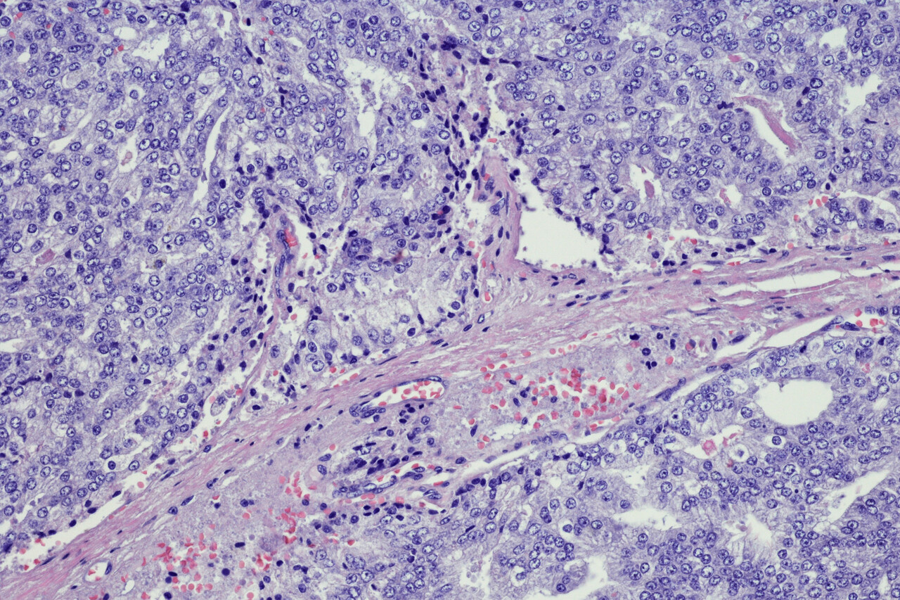 Monotherapy, Doublet Therapy, and Triplet Therapy for Advanced Prostate ...