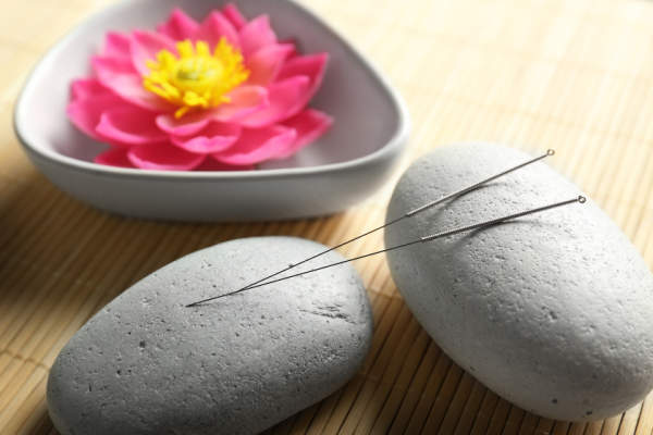 Lotus在石碗，石针灸针。