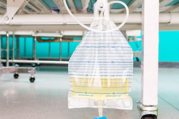 导管包挂病床。