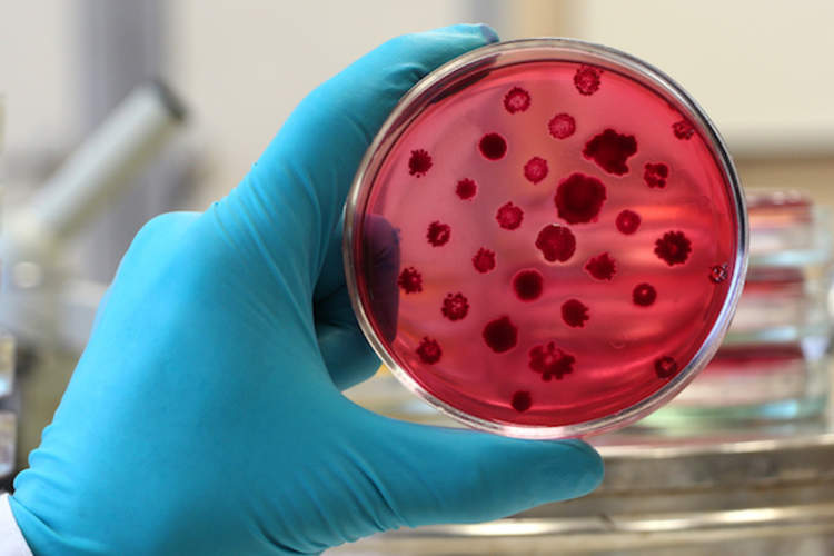 警告关于“超级病菌”