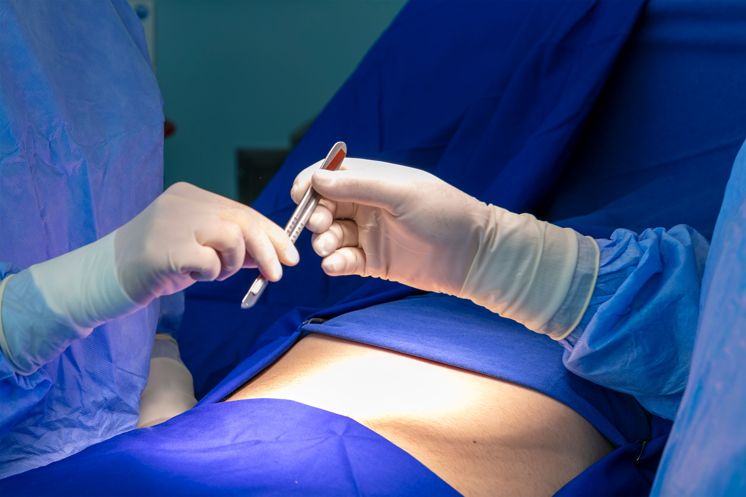 Crohn's Disease Features in Anastomotic Biopsies from Patients