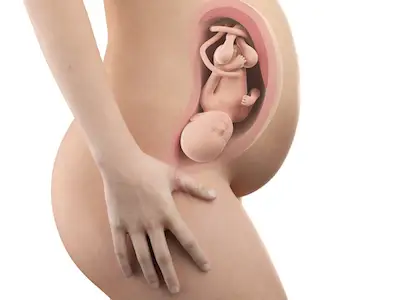 第八个月子宫剪裁，怀孕。