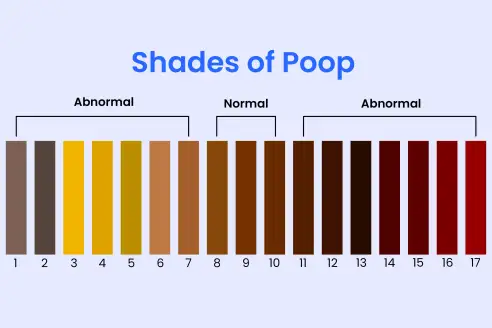Yellow Poop: What Does It Mean and Should I Be Worried?