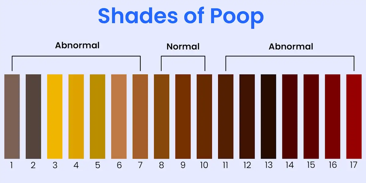 Yellow Poop: Causes and What It Means for Your Health