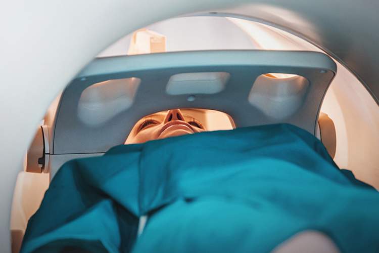 核磁共振成像扫描。