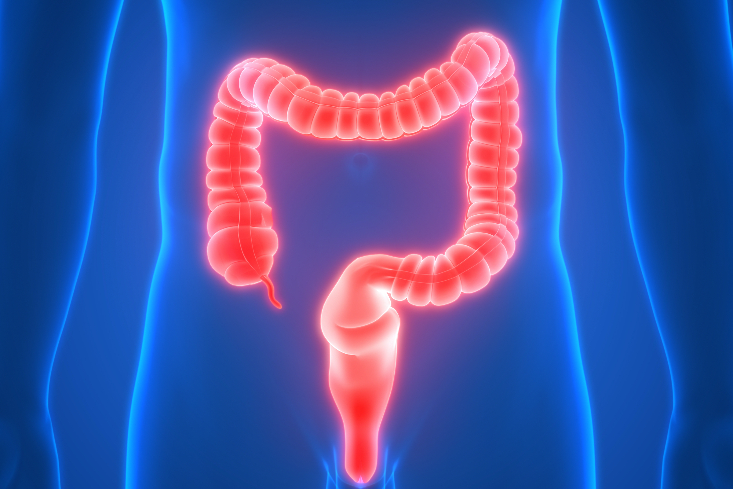 Understanding the Different Types of Ulcerative Colitis