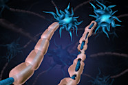 Learn More About MS And The Myelin Sheath