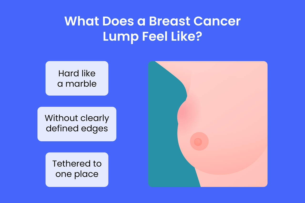 What Does a Breast Cancer Lump Feel Like