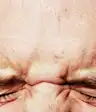 眼痛