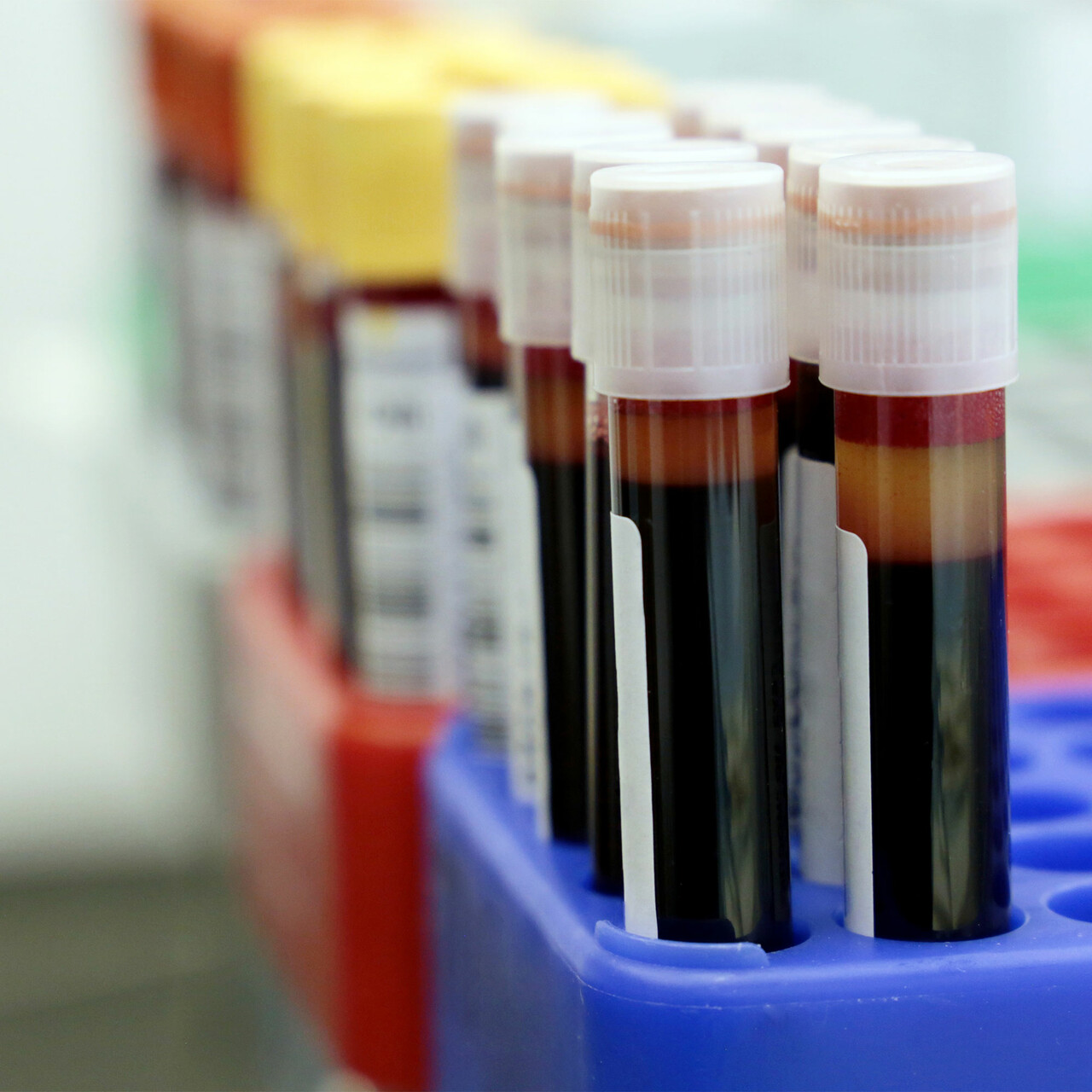 带有血液的测试管的视图