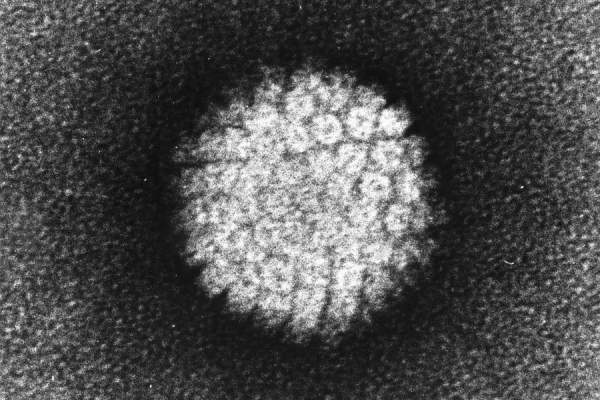 负染人乳头状瘤病毒（HPV）的电子显微照片