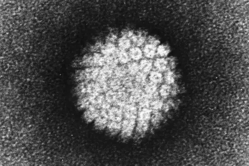 带负染色的人乳头瘤病毒（HPV）的电子显微照片