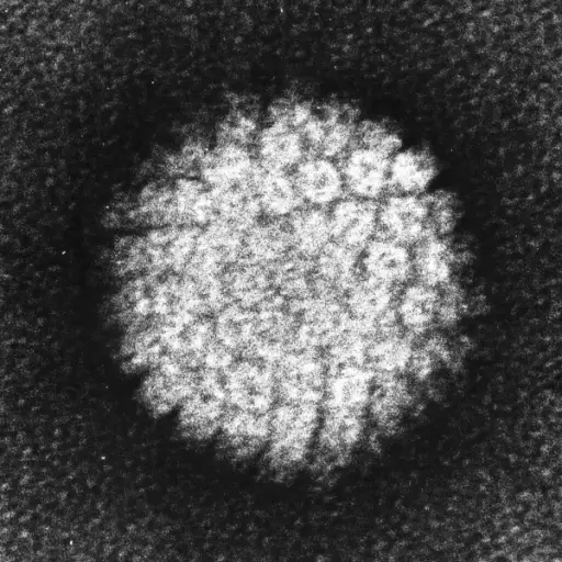 带负染色的人乳头瘤病毒（HPV）的电子显微照片