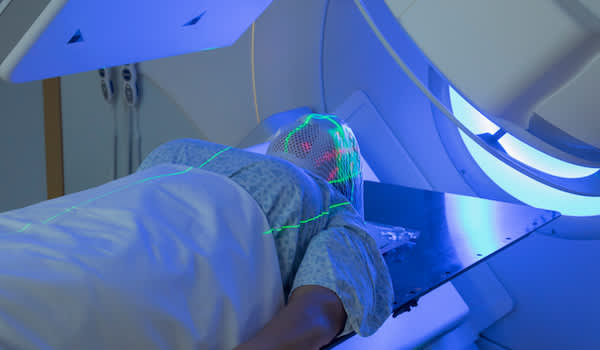 女子接受放射治疗脑癌。